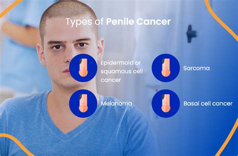 what is penile cancer